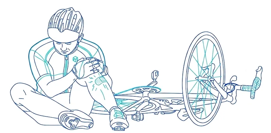 Ilustración: otros accidentes con lesiones